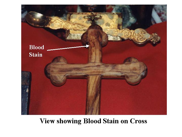 Blood Stains